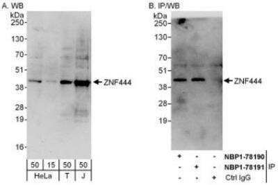 Western Blot: ZNF444 Antibody [NBP1-78190] - Whole cell lysate from HeLa (15 and 50 mcg for WB; 1 mg for IP, 20% of IP loaded), 293T (T; 50 mcg) and Jurkat (J; 50 mcg) cells. Affinity purified rabbit anti-ZNF444 antibody  used for WB at 0.4 mcg/ml (A) and 1 mcg/ml (B) and used for IP at 6 mcg/mg lysate.  ZNF444 was also immunoprecipitated by rabbit anti-ZNF444 antibodyNBP1-78191, which recognizes a downstream epitope.