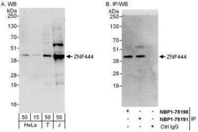 Western Blot: ZNF444 Antibody [NBP1-78191] - Whole cell lysate from HeLa (15 and 50 mcg for WB; 1 mg for IP, 20% of IP loaded), 293T (T; 50 mcg) and Jurkat (J; 50 mcg) cells. Affinity purified rabbit anti-ZNF444 antibody used for WB at 0.4 mcg/ml (A) and 1 mcg/ml (B) and used for IP at 6 mcg/mg lysate.  ZNF444 was also immunoprecipitated by rabbit anti-ZNF444 antibody NBP1-78190, which recognizes an upstream epitope.