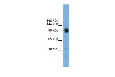Western Blot: ZNF445 Antibody [NBP3-10443] - Western blot analysis of ZNF445 in Mouse Brain as a positive control. Antibody dilution at 0.2-1 ug/ml