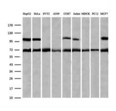 Western Blot: ZNF447 Antibody (OTI2H7) - Azide and BSA Free [NBP2-74951] - Analysis of extracts (35ug) from 9 different cell lines by using g ZSCAN18 monoclonal antibody (HepG2: human; HeLa: human; SVT2: mouse; A549: human; COS7: monkey; Jurkat: human; MDCK: canine; PC12: rat; MCF7: human).