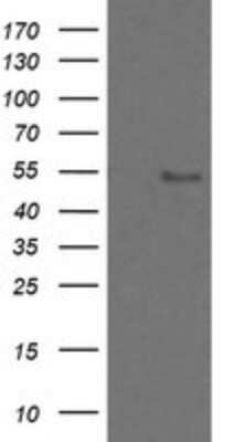 Western Blot: ZNF447 Antibody (OTI2H7) - Azide and BSA Free [NBP2-74951] - Analysis of HEK293T cells were transfected with the pCMV6-ENTRY control (Left lane) or pCMV6-ENTRY ZNF447.