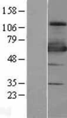 Western Blot ZNF447 Overexpression Lysate