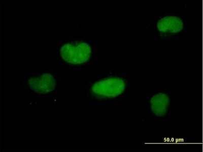 Immunocytochemistry/Immunofluorescence: ZNF449 Antibody [H00203523-B01P] - Analysis of purified antibody to ZNF449 on HeLa cell. (antibody concentration 10 ug/ml)