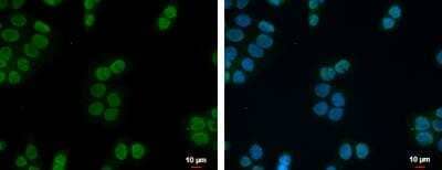 Immunocytochemistry/ Immunofluorescence ZNF45 Antibody - BSA Free