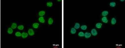 Immunocytochemistry/ Immunofluorescence ZNF45 Antibody - BSA Free
