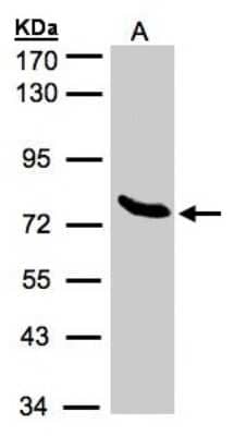 Western Blot ZNF45 Antibody - BSA Free