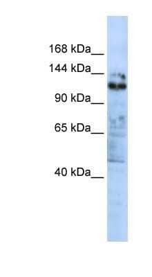 Western Blot: ZNF451 Antibody [NBP1-80330] - Titration: 0.2-1 ug/ml, Positive Control: MCF7 cell lysate.