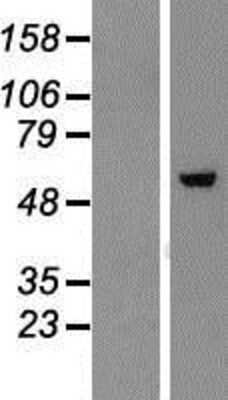 Western Blot ZNF454 Overexpression Lysate