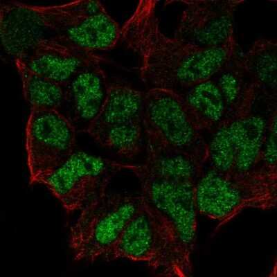 Immunocytochemistry/Immunofluorescence: ZNF460 Antibody [NBP2-56515] - Staining of human cell line HEK 293 shows localization to nucleoplasm.