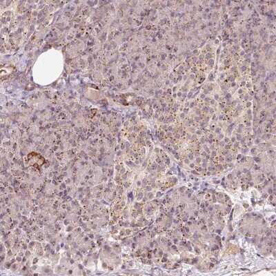 Immunohistochemistry: ZNF460 Antibody [NBP2-49069] - Staining of human pancreas shows distinct dot like cytoplasmic positivity in exocrine glandular cells and islets of Langerhans.