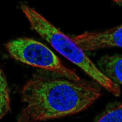 Immunocytochemistry/Immunofluorescence: ZNF467 Antibody [NBP1-92626] - Staining of human cell line PC-3 shows localization to mitochondria. Antibody staining is shown in green.