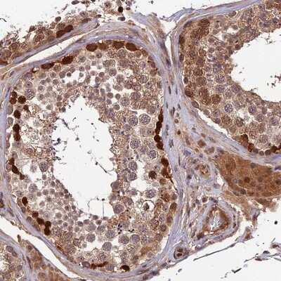 Immunohistochemistry-Paraffin: ZNF467 Antibody [NBP1-92626] - Staining of human testis shows strong nuclear and cytoplasmic positivity in Spermatogonia
