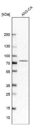 Western Blot: ZNF467 Antibody [NBP1-92626] - Analysis in human cell line AN3-CA.