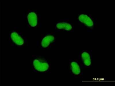 Immunocytochemistry/Immunofluorescence: ZNF468 Antibody [H00090333-B01P] - Analysis of purified antibody to ZNF468 on HepG2 cell. (antibody concentration 10 ug/ml)