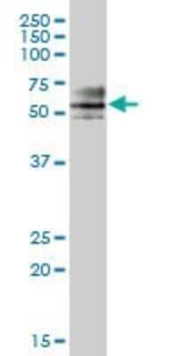 Western Blot: ZNF468 Antibody [H00090333-B01P] - Analysis of ZNF468 expression in human pancreas.