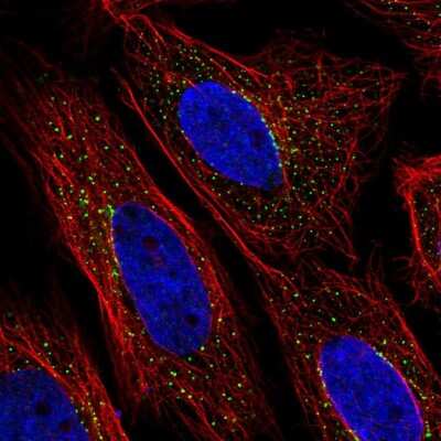Immunocytochemistry/Immunofluorescence: ZNF469 Antibody [NBP2-57206] - Staining of human cell line SiHa shows localization to vesicles. Antibody staining is shown in green.