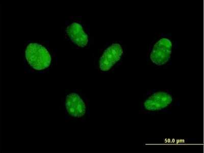 Immunocytochemistry/Immunofluorescence: ZNF471 Antibody [H00057573-B01P] - Analysis of purified antibody to ZNF471 on Daoy cell. (antibody concentration 10 ug/ml)