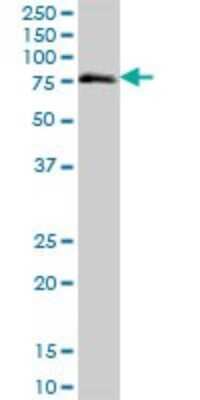 Western Blot: ZNF471 Antibody [H00057573-B01P] - Analysis of ZNF471 expression in RIN-m5F.