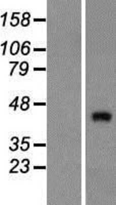 Western Blot ZNF474 Overexpression Lysate