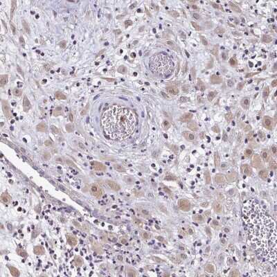 Immunohistochemistry: ZNF475 Antibody [NBP2-38009] - Staining of human placenta shows weak cytoplasmic and nuclear positivity in decidua cells.