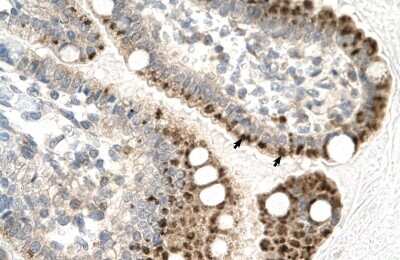 Immunohistochemistry-Paraffin: ZNF475 Antibody [NBP2-86498] - Rabbit Anti-ZFP1 Antibody. Paraffin Embedded Tissue: Human Intestine. Cellular Data: Epithelial cells of intestinal villas. Antibody Concentration: 4.0-8.0 ug/ml. Magnification: 400X