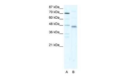 Western Blot: ZNF475 Antibody [NBP2-86430] - WB Suggested Anti-ZFP1 Antibody Titration: 2.5ug/ml. ELISA Titer: 1:1562500. Positive Control: HepG2 cell lysate