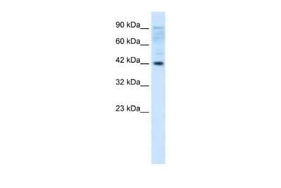 Western Blot: ZNF475 Antibody [NBP2-86498] - Jurkat Whole Cell
