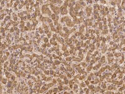 Immunohistochemistry-Paraffin: ZNF480 Antibody [NBP3-06332] - Immunochemical staining of human ZNF480 in human liver with rabbit polyclonal antibody at 1:300 dilution, formalin-fixed paraffin embedded sections.
