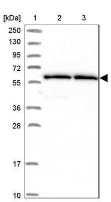 Western Blot: ZNF480 Antibody [NBP1-81124] - Lane 1: Marker  [kDa] 250, 130, 95, 72, 55, 36, 28, 17, 10.  Lane 2: Human cell line RT-4.  Lane 3: Human cell line U-251MG sp