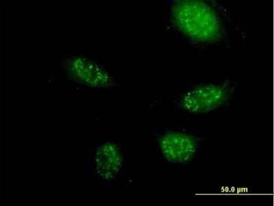 Immunocytochemistry/ Immunofluorescence ZNF483 Antibody