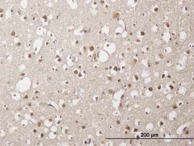 Immunohistochemistry-Paraffin ZNF483 Antibody