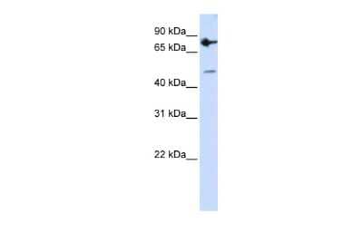 Western Blot: ZNF483 Antibody [NBP2-88601] - WB Suggested Anti-ZNF483 Antibody Titration: 0.2-1 ug/ml. ELISA Titer: 1:312500. Positive Control: MCF7 cell lysate