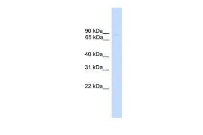 Western Blot: ZNF483 Antibody [NBP2-88696] - WB Suggested Anti-ZNF483 Antibody Titration: 0.2-1 ug/ml. Positive Control: Human Liver