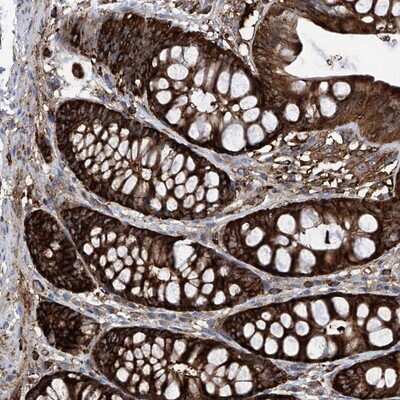 Immunohistochemistry-Paraffin: ZNF484 Antibody [NBP1-88750] - Staining of human colon shows strong cytoplasmic positivity in glandular cells.
