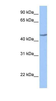 Western Blot: ZNF485 Antibody [NBP1-80146] - Jurkat cell lysate, concentration 0.2-1 ug/ml.