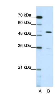 Western Blot ZNF485 Antibody - BSA Free