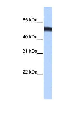 Western Blot: ZNF486 Antibody [NBP1-79462] - Human Muscle lysate, concentration 0.2-1 ug/ml.