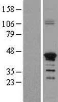 Western Blot: ZNF488 Overexpression Lysate (Adult Normal) [NBL1-18164] Left-Empty vector transfected control cell lysate (HEK293 cell lysate); Right -Over-expression Lysate for ZNF488.