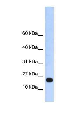 Western Blot ZNF493 Antibody - BSA Free