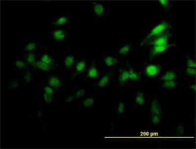 Immunocytochemistry/Immunofluorescence: ZNF496 Antibody (4B1) [H00084838-M02] - Analysis of monoclonal antibody to ZNF496 on HeLa cell. Antibody concentration 10 ug/ml.