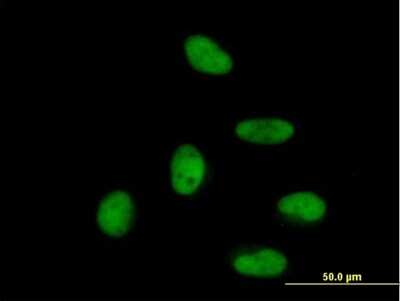 Immunocytochemistry/Immunofluorescence: ZNF496 Antibody [H00084838-B01P] - Analysis of purified antibody to ZNF496 on HeLa cell. (antibody concentration 10 ug/ml)