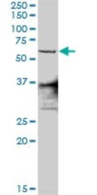 Western Blot: ZNF496 Antibody [H00084838-D01P] - Analysis of ZNF496 expression in A-431.