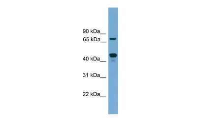 Western Blot: ZNF496 Antibody [NBP3-10442] - Western blot analysis of ZNF496 in SP2/0 cell lysate as a positive control. Antibody dilution at 0.2-1 ug/ml