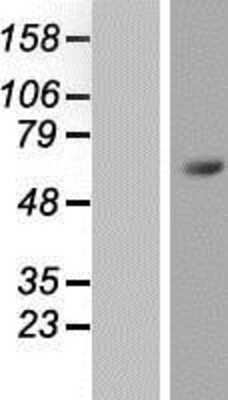 Western Blot: ZNF496 Overexpression Lysate (Adult Normal) [NBP2-05975] Left-Empty vector transfected control cell lysate (HEK293 cell lysate); Right -Over-expression Lysate for ZNF496.