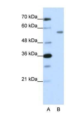 Western Blot: ZNF497 Antibody [NBP1-80438] - HepG2 cell lysate, concentration 1.25ug/ml.