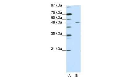 Western Blot: ZNF498 Antibody [NBP2-86506] - WB Suggested Anti-ZNF498 Antibody Titration: 5.0ug/ml. ELISA Titer: 1:312500. Positive Control: Jurkat cell lysate