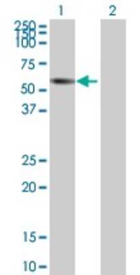 Western Blot: ZNF502 Antibody [H00091392-B01P] - Analysis of ZNF502 expression in transfected 293T cell line by ZNF502 polyclonal antibody.  Lane 1: ZNF502 transfected lysate(59.84 KDa). Lane 2: Non-transfected lysate.