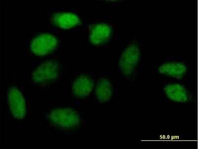 Immunocytochemistry/Immunofluorescence: ZNF503 Antibody [H00084858-B01P] - Analysis of purified antibody to ZNF503 on HeLa cell. (antibody concentration 10 ug/ml)