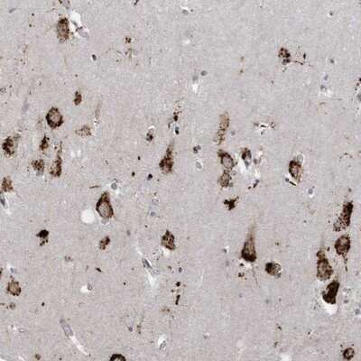 Immunohistochemistry-Paraffin: ZNF507 Antibody [NBP1-82932] - Staining of human hippocampus shows strong cytoplasmic positivity in neuronal cells.