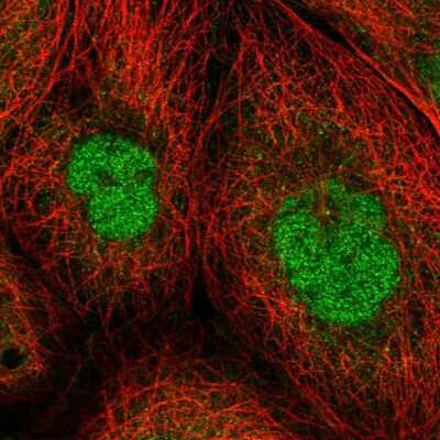 Immunocytochemistry/Immunofluorescence: ZNF509 Antibody [NBP1-92628] - Immunofluorescent staining of human cell line A-431 shows localization to nucleoplasm & cytosol.